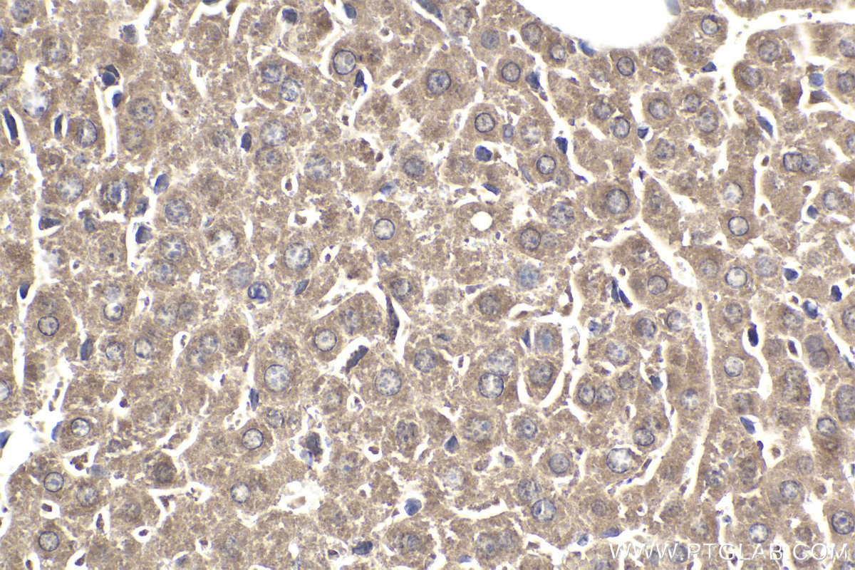 Immunohistochemical analysis of paraffin-embedded mouse liver tissue slide using KHC1899 (ATF6B IHC Kit).