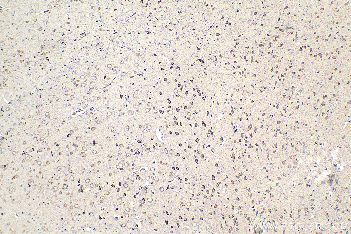 Immunohistochemical analysis of paraffin-embedded mouse brain tissue slide using KHC1553 (ATF7 IHC Kit).
