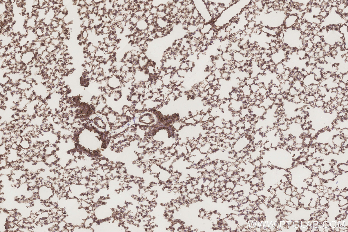 Immunohistochemical analysis of paraffin-embedded mouse lung tissue slide using KHC3259 (ATG2A IHC Kit).