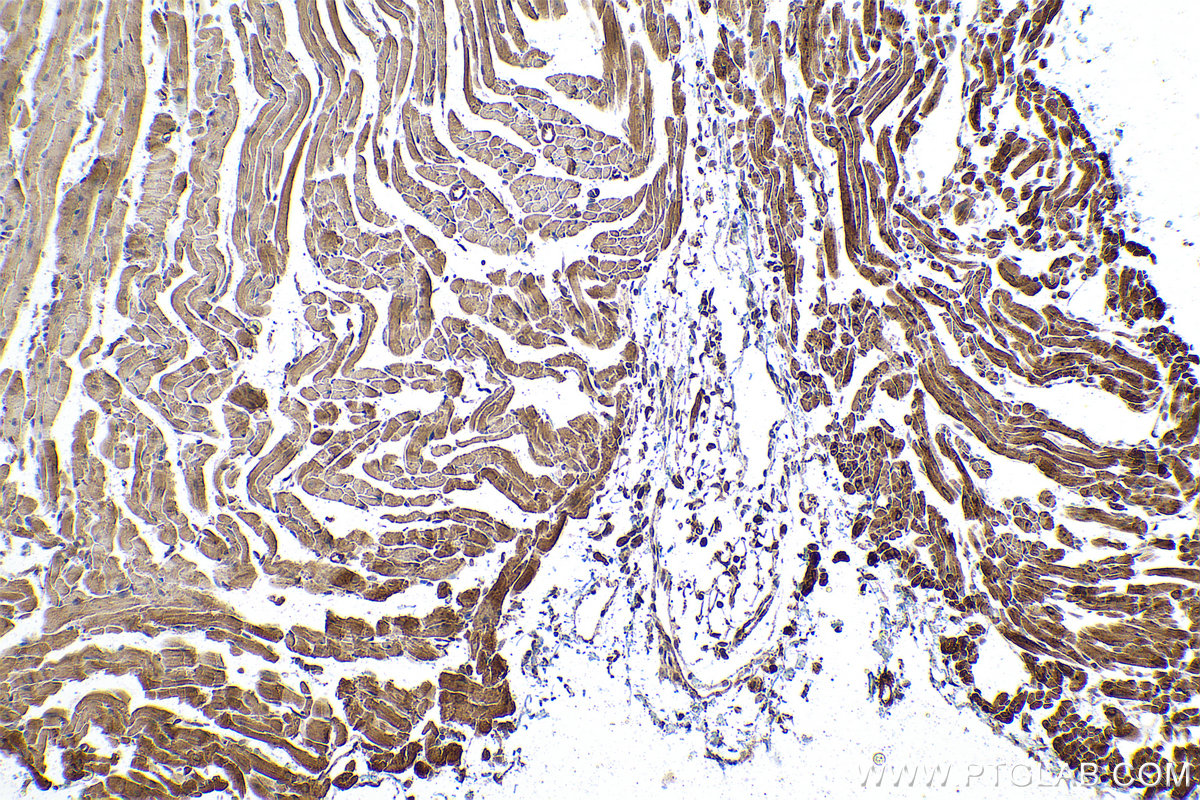 Immunohistochemical analysis of paraffin-embedded mouse heart tissue slide using KHC0932 (ATOX1 IHC Kit).