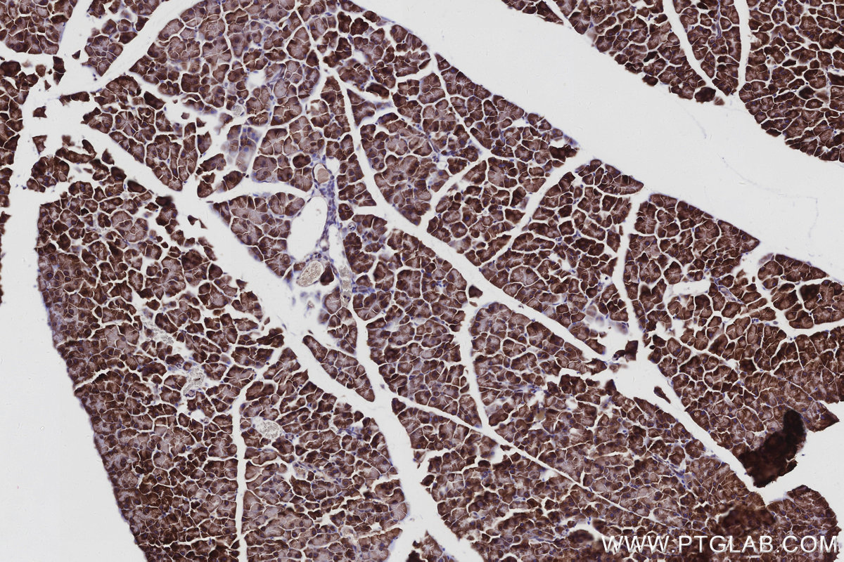Immunohistochemical analysis of paraffin-embedded mouse pancreas tissue slide using KHC2962 (ATP13A1 IHC Kit). Immunohistochemical analysis of paraffin-embedded mouse pancreas tissue slide using KHC2962 (ATP13A1 IHC Kit).