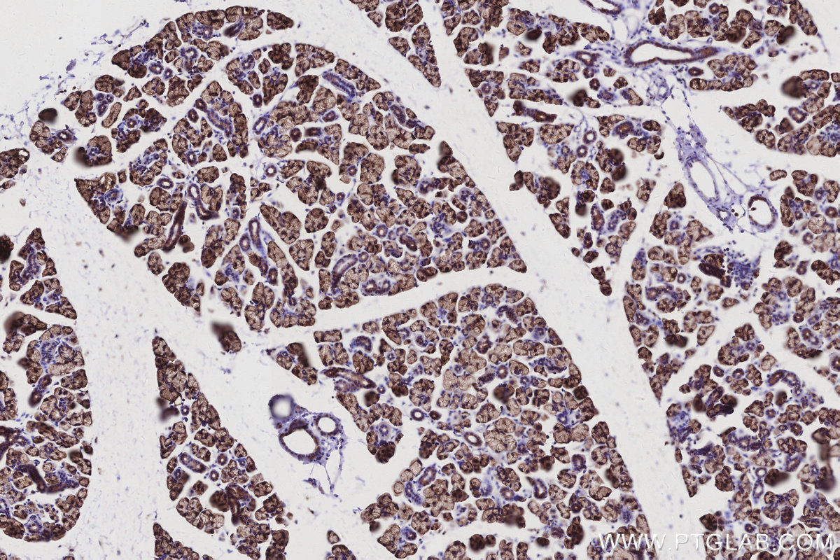 Immunohistochemical analysis of paraffin-embedded mouse salivary gland tissue slide using KHC2962 (ATP13A1 IHC Kit). Immunohistochemical analysis of paraffin-embedded mouse salivary gland tissue slide using KHC2962 (ATP13A1 IHC Kit).