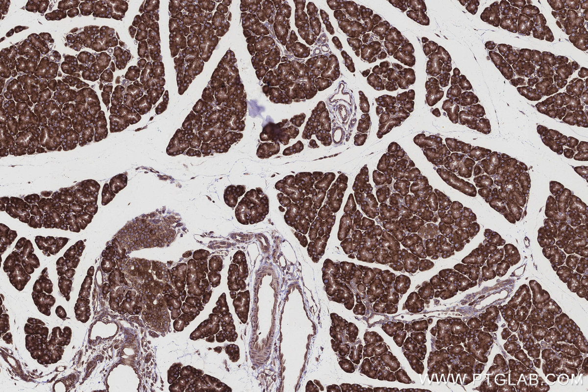 Immunohistochemical analysis of paraffin-embedded rat pancreas tissue slide using KHC2962 (ATP13A1 IHC Kit). Immunohistochemical analysis of paraffin-embedded rat pancreas tissue slide using KHC2962 (ATP13A1 IHC Kit).