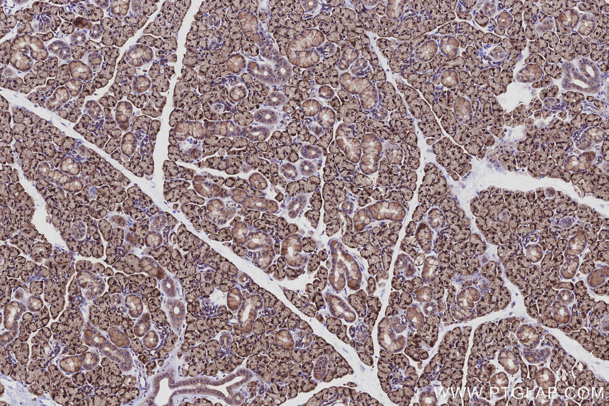 Immunohistochemical analysis of paraffin-embedded rat salivary gland tissue slide using KHC2962 (ATP13A1 IHC Kit). Immunohistochemical analysis of paraffin-embedded rat salivary gland tissue slide using KHC2962 (ATP13A1 IHC Kit).