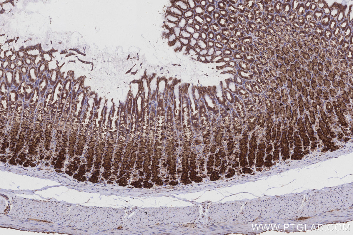 Immunohistochemical analysis of paraffin-embedded rat stomach tissue slide using KHC2962 (ATP13A1 IHC Kit). Immunohistochemical analysis of paraffin-embedded rat stomach tissue slide using KHC2962 (ATP13A1 IHC Kit).