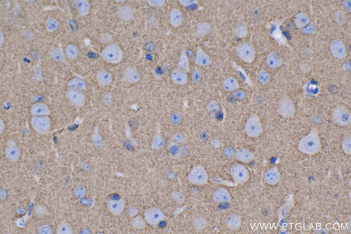 Immunohistochemical analysis of paraffin-embedded mouse brain tissue slide using KHC1274 (ATP1A3 IHC Kit).