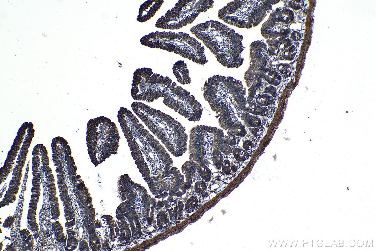 Immunohistochemical analysis of paraffin-embedded mouse small intestine tissue slide using KHC1117 (ATP2B1 IHC Kit).