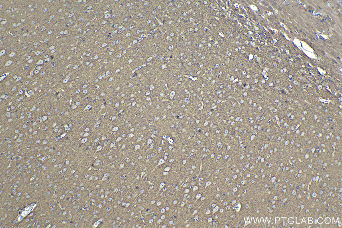 Immunohistochemical analysis of paraffin-embedded mouse brain tissue slide using KHC1117 (ATP2B1 IHC Kit).