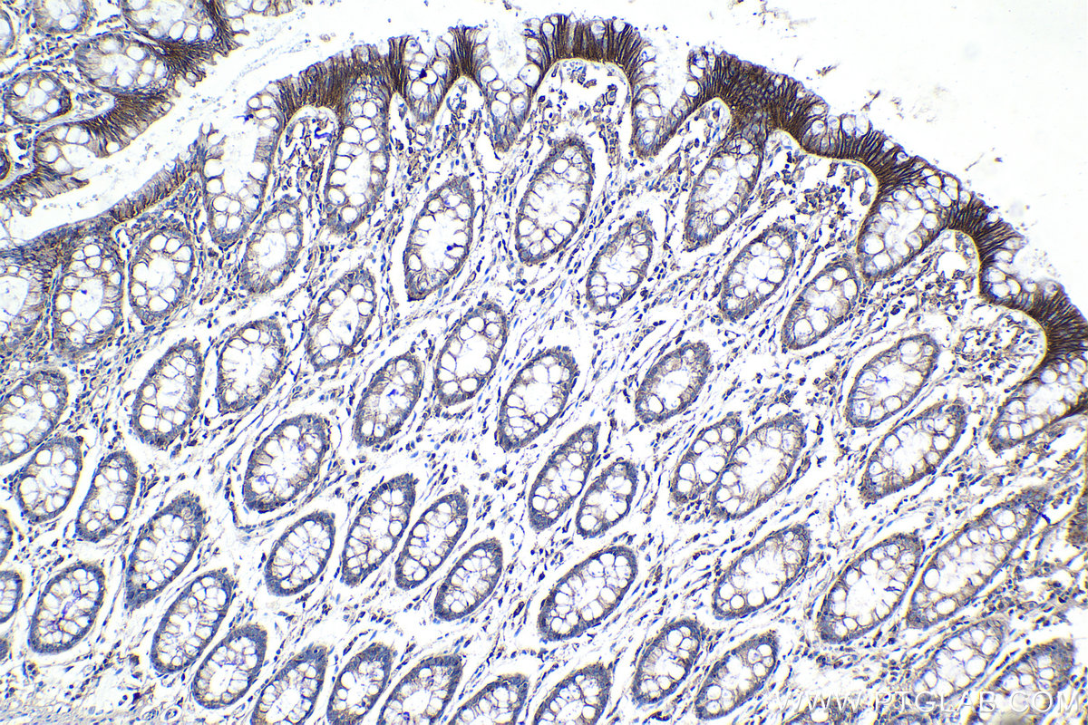 Immunohistochemical analysis of paraffin-embedded human colon tissue slide using KHC1117 (ATP2B1 IHC Kit).