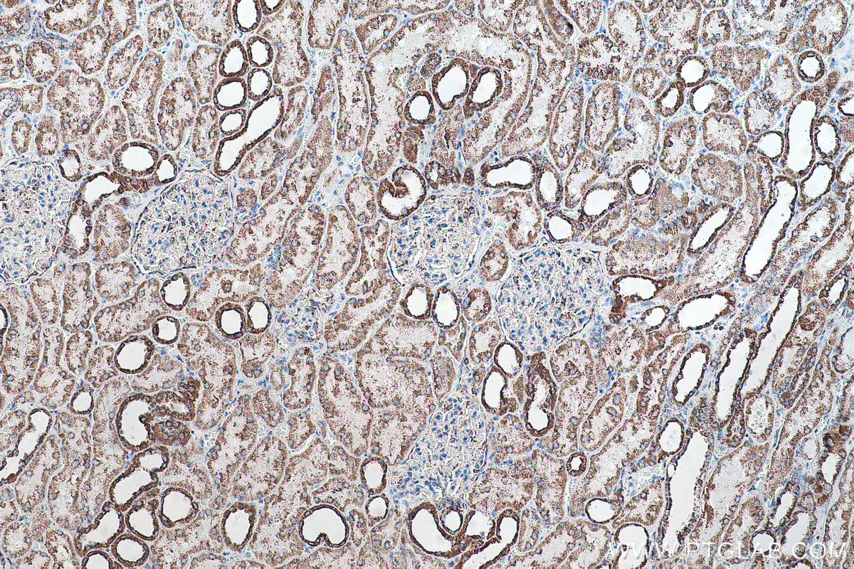 Immunohistochemical analysis of paraffin-embedded human kidney tissue slide using KHC0510 (ATP5B IHC Kit).