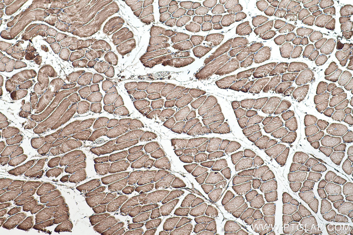 Immunohistochemical analysis of paraffin-embedded mouse skeletal muscle tissue slide using KHC0510 (ATP5B IHC Kit).