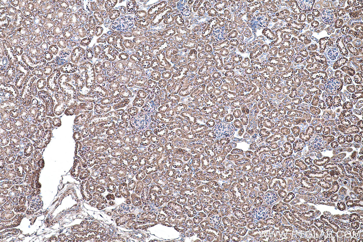 Immunohistochemical analysis of paraffin-embedded mouse kidney tissue slide using KHC0510 (ATP5B IHC Kit).