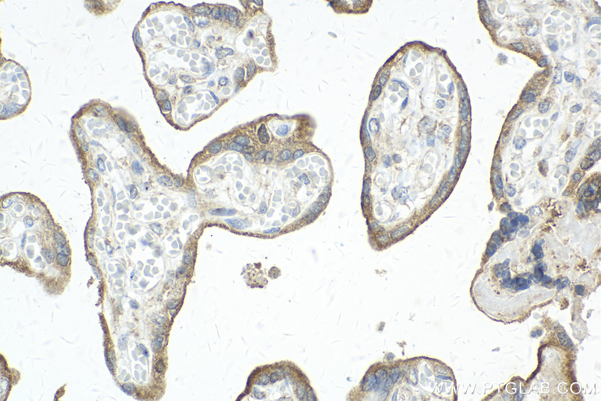Immunohistochemical analysis of paraffin-embedded human placenta tissue slide using KHC2120 (ATP6AP2 IHC Kit).