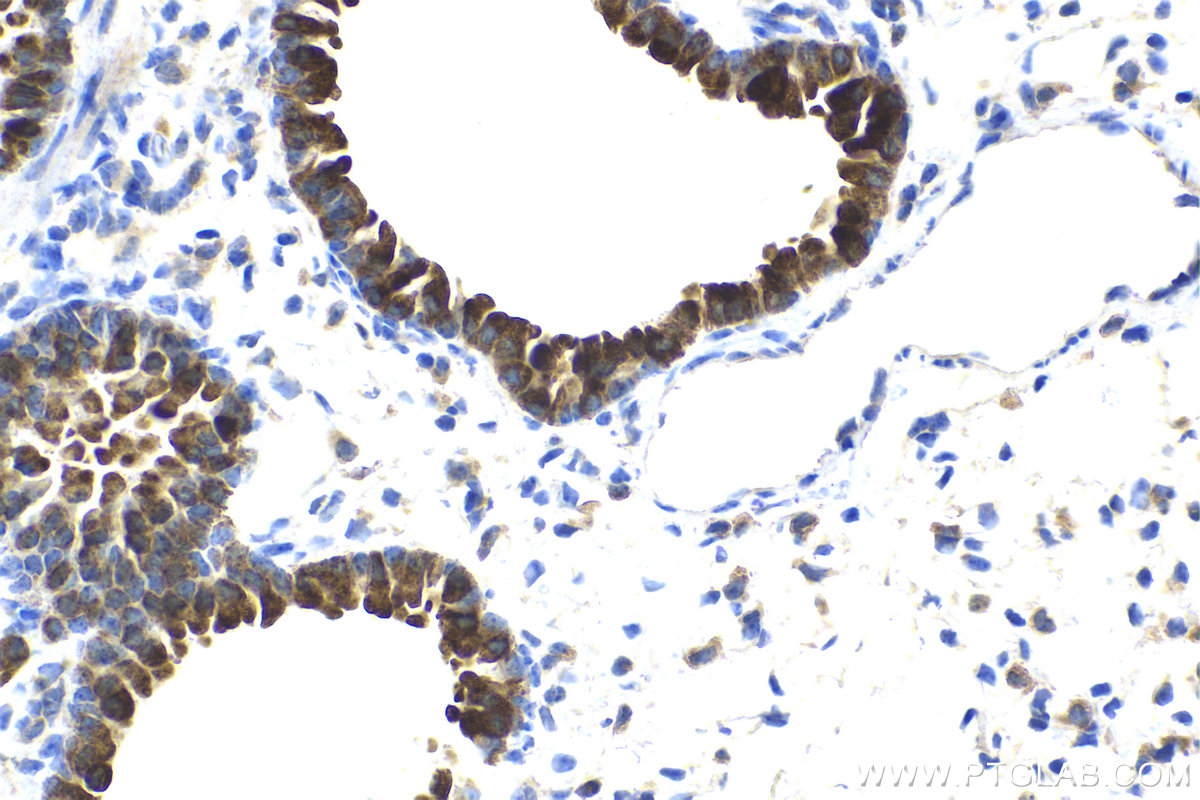 Immunohistochemical analysis of paraffin-embedded mouse lung tissue slide using KHC2120 (ATP6AP2 IHC Kit).