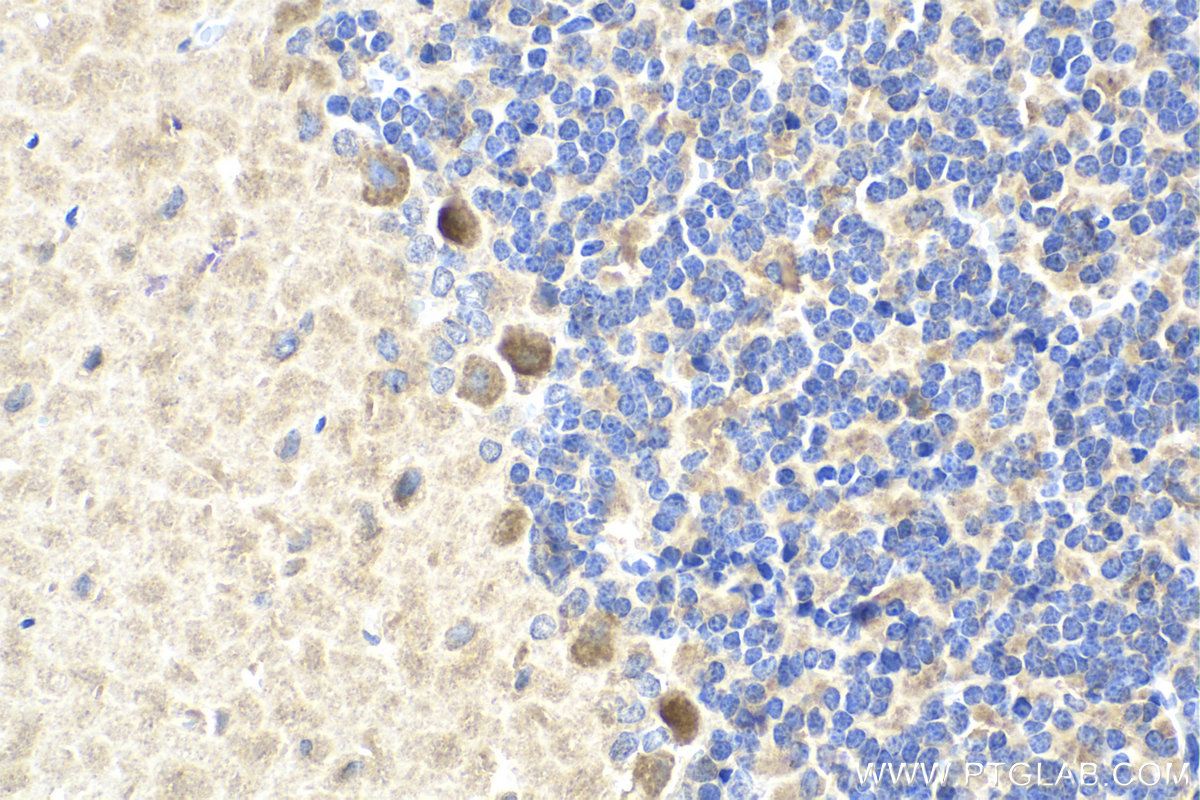 Immunohistochemical analysis of paraffin-embedded rat cerebellum tissue slide using KHC2120 (ATP6AP2 IHC Kit).