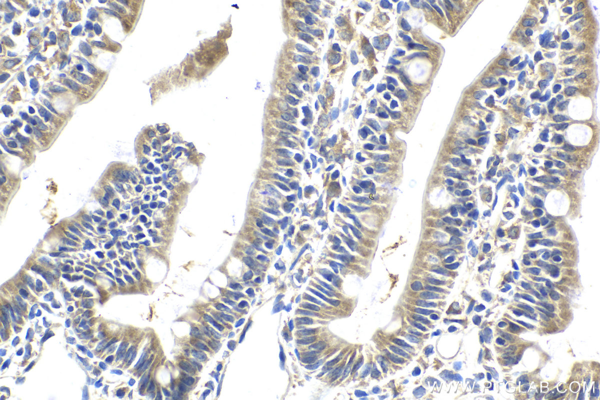 Immunohistochemical analysis of paraffin-embedded rat small intestine tissue slide using KHC2120 (ATP6AP2 IHC Kit).