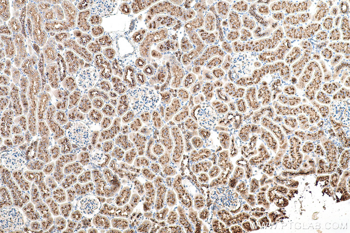 Immunohistochemical analysis of paraffin-embedded rat kidney tissue slide using KHC0959 (ATP6V1G1 IHC Kit).