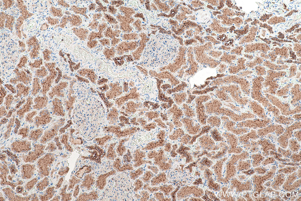 Immunohistochemical analysis of paraffin-embedded human kidney tissue slide using KHC0959 (ATP6V1G1 IHC Kit).