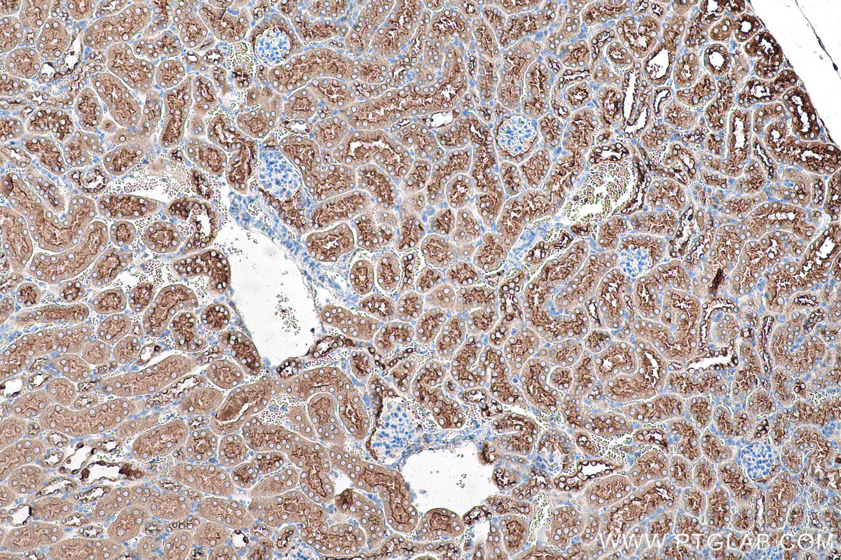 Immunohistochemical analysis of paraffin-embedded mouse kidney tissue slide using KHC0959 (ATP6V1G1 IHC Kit).