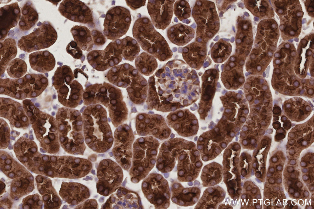 Immunohistochemical analysis of paraffin-embedded mouse kidney tissue slide using KHC3027 (ATP6V1H IHC Kit). Immunohistochemical analysis of paraffin-embedded mouse kidney tissue slide using KHC3027 (ATP6V1H IHC Kit).