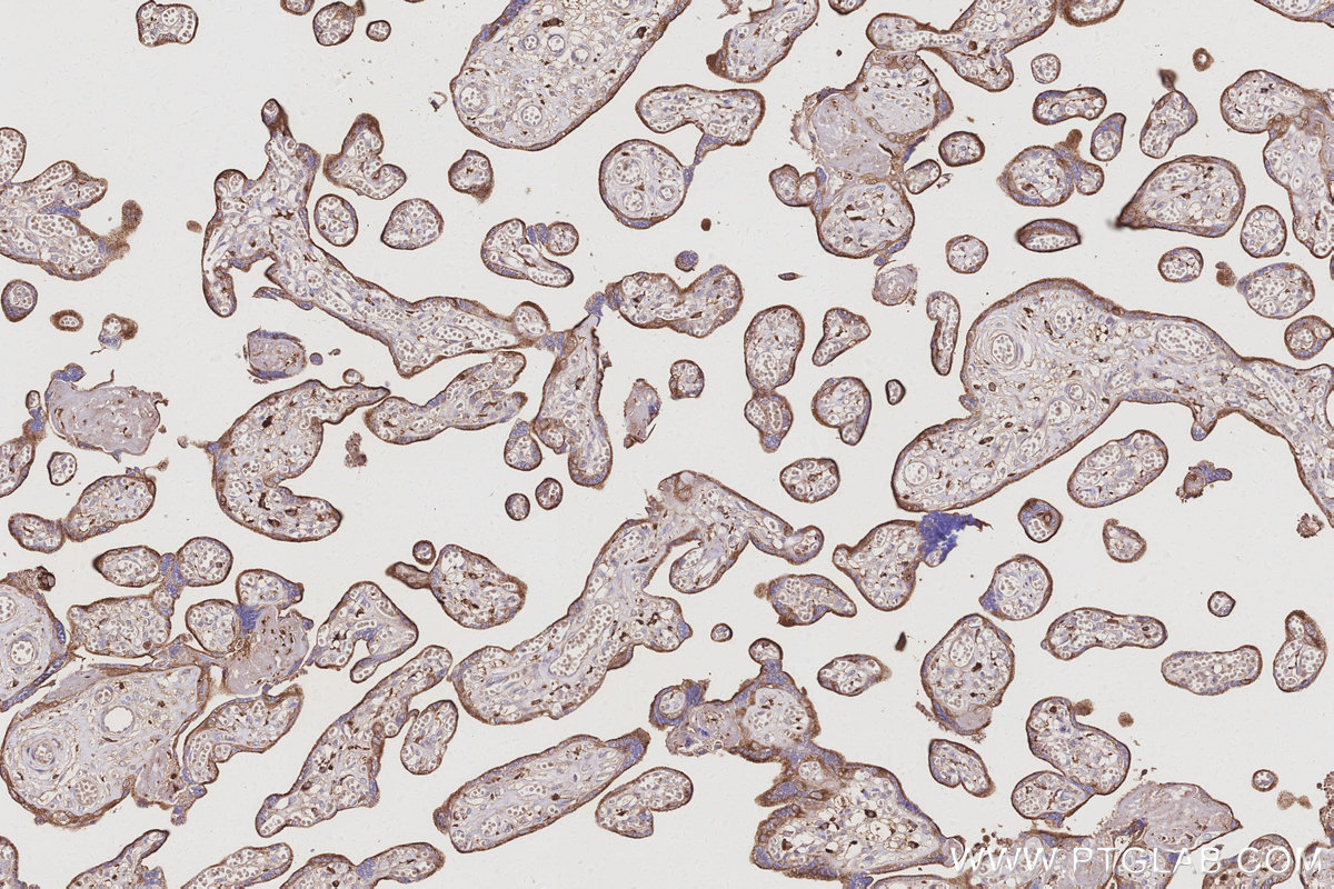 Immunohistochemical analysis of paraffin-embedded human placenta tissue slide using KHC3027 (ATP6V1H IHC Kit). Immunohistochemical analysis of paraffin-embedded human placenta tissue slide using KHC3027 (ATP6V1H IHC Kit).