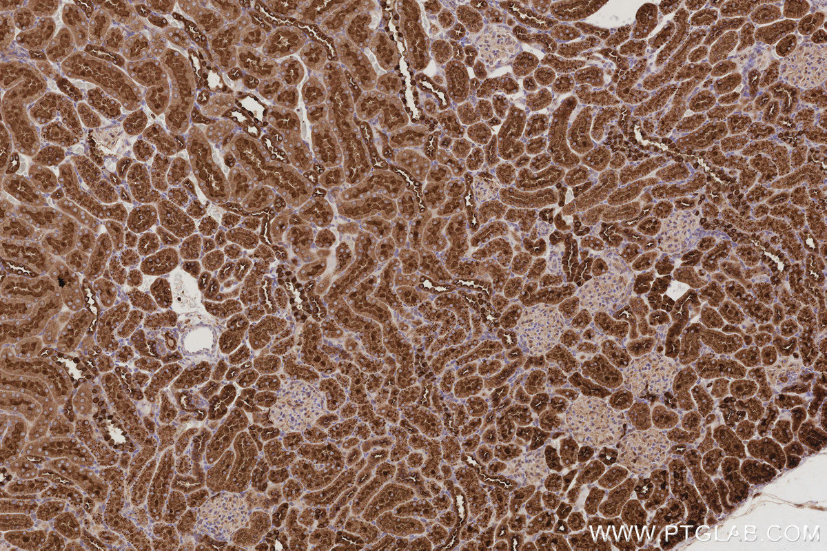 Immunohistochemical analysis of paraffin-embedded rat kidney tissue slide using KHC3027 (ATP6V1H IHC Kit). Immunohistochemical analysis of paraffin-embedded rat kidney tissue slide using KHC3027 (ATP6V1H IHC Kit).