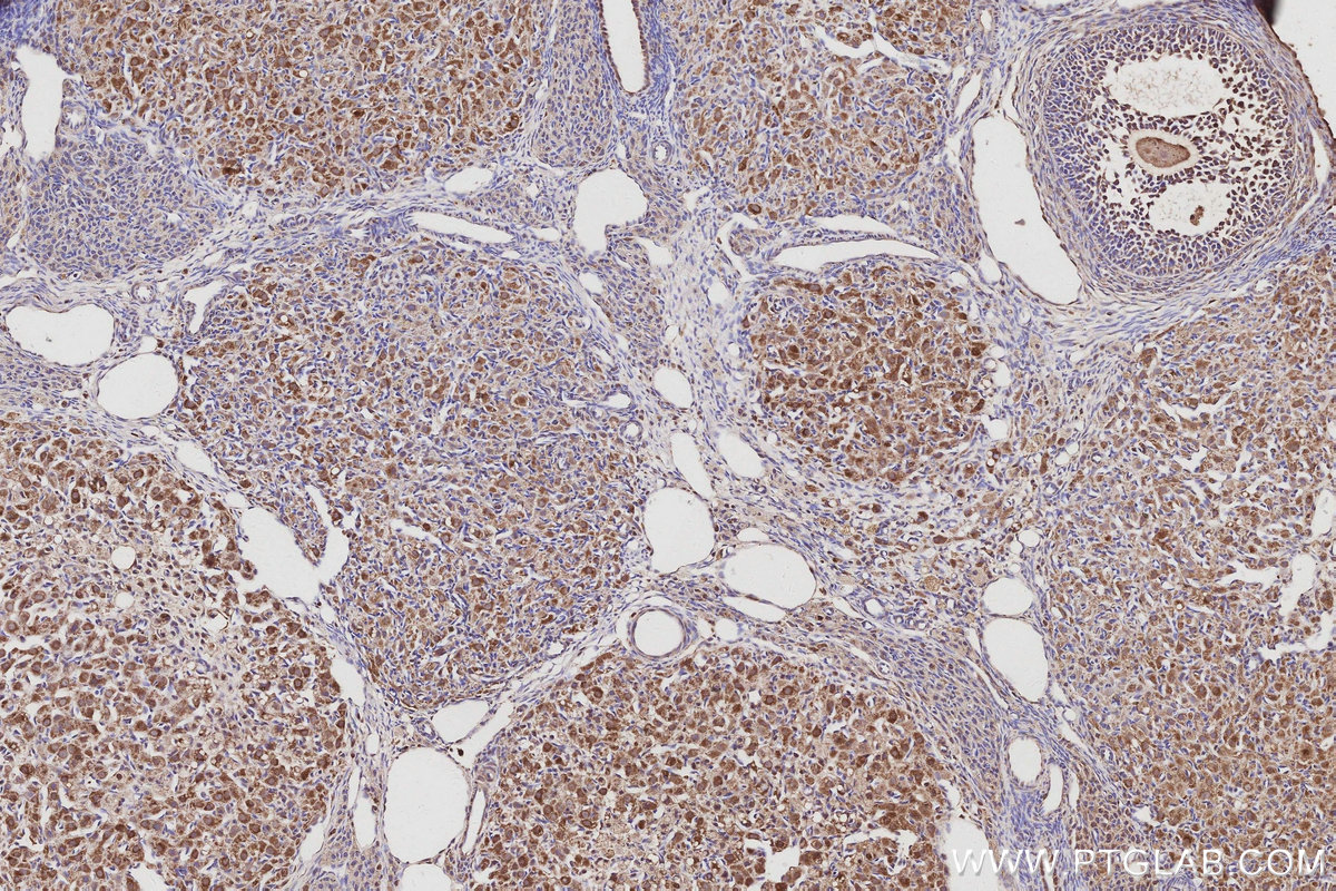 Immunohistochemical analysis of paraffin-embedded rat ovary tissue slide using KHC3056 (ATP8A1 IHC Kit). Immunohistochemical analysis of paraffin-embedded rat ovary tissue slide using KHC3056 (ATP8A1 IHC Kit).