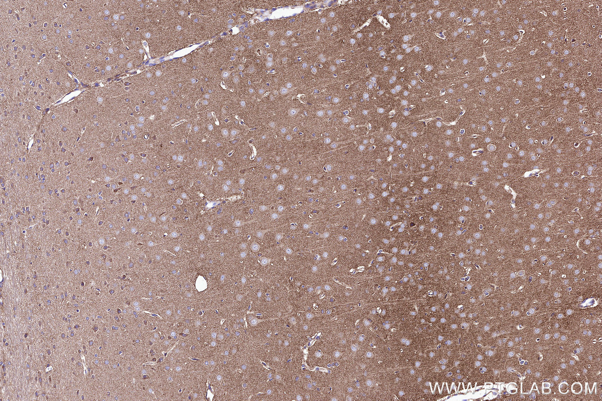 Immunohistochemical analysis of paraffin-embedded rat brain tissue slide using KHC3105 (ATPBD3 IHC Kit). Immunohistochemical analysis of paraffin-embedded rat brain tissue slide using KHC3105 (ATPBD3 IHC Kit).