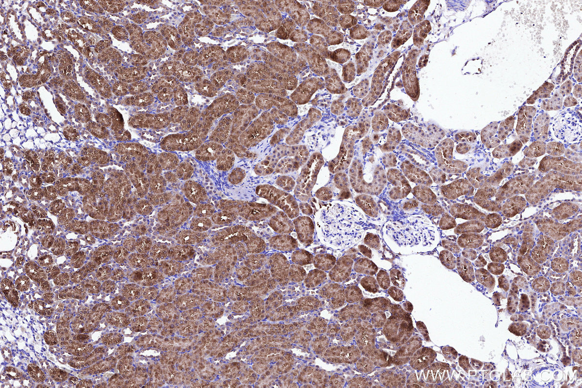 Immunohistochemical analysis of paraffin-embedded rat kidney tissue slide using KHC3105 (ATPBD3 IHC Kit). Immunohistochemical analysis of paraffin-embedded rat kidney tissue slide using KHC3105 (ATPBD3 IHC Kit).