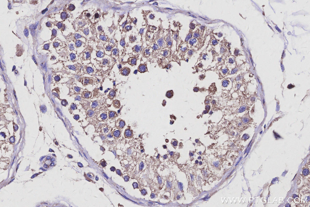 Immunohistochemical analysis of paraffin-embedded human testis tissue slide using KHC3118 (AVEN IHC Kit). Immunohistochemical analysis of paraffin-embedded human testis tissue slide using KHC3118 (AVEN IHC Kit).