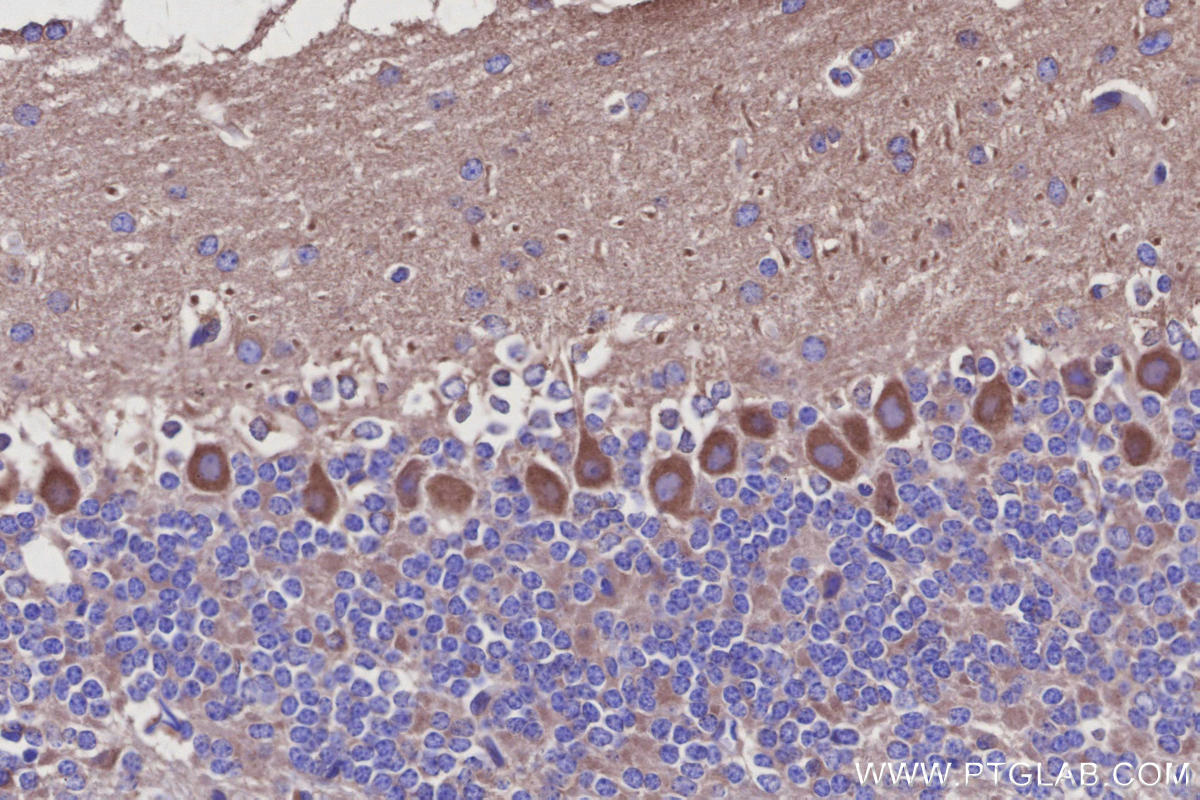 Immunohistochemical analysis of paraffin-embedded mouse cerebellum tissue slide using KHC3118 (AVEN IHC Kit). Immunohistochemical analysis of paraffin-embedded mouse cerebellum tissue slide using KHC3118 (AVEN IHC Kit).