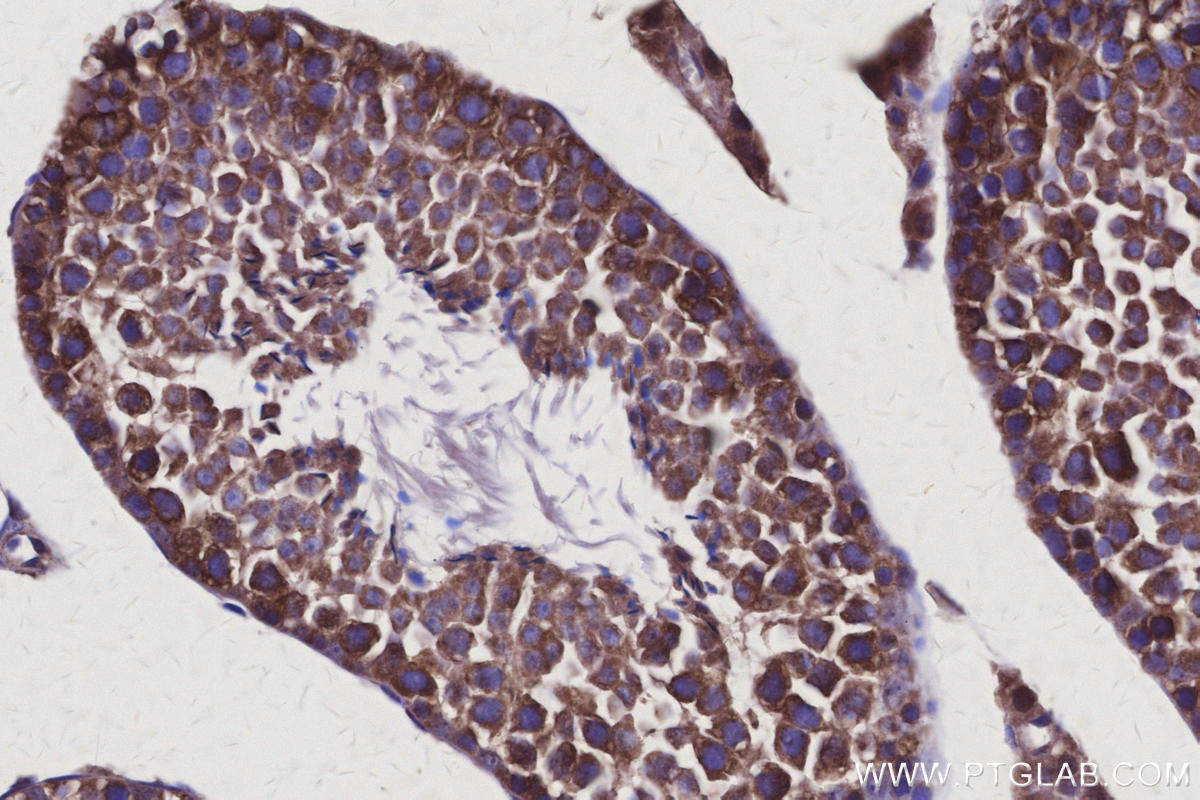 Immunohistochemical analysis of paraffin-embedded mouse testis tissue slide using KHC3118 (AVEN IHC Kit). Immunohistochemical analysis of paraffin-embedded mouse testis tissue slide using KHC3118 (AVEN IHC Kit).