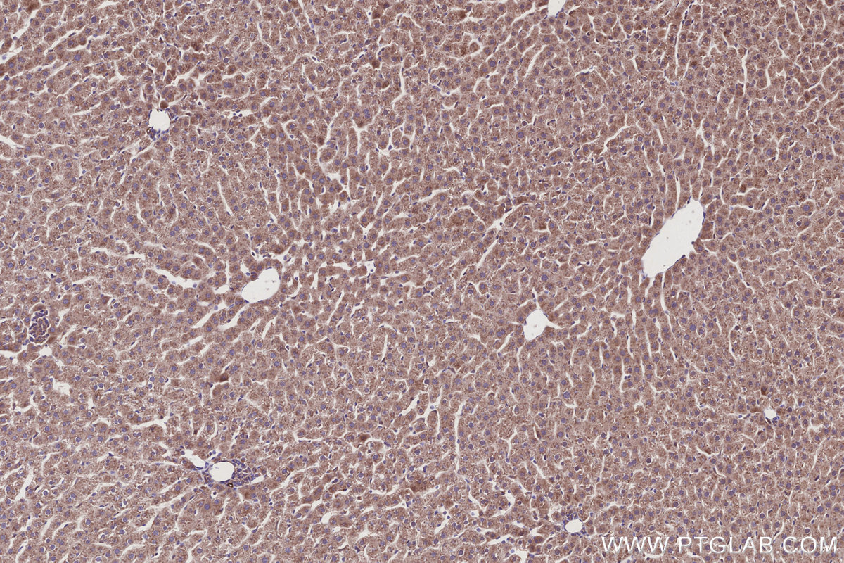Immunohistochemical analysis of paraffin-embedded rat liver tissue slide using KHC2922 (AZI2/NAP1 IHC Kit).