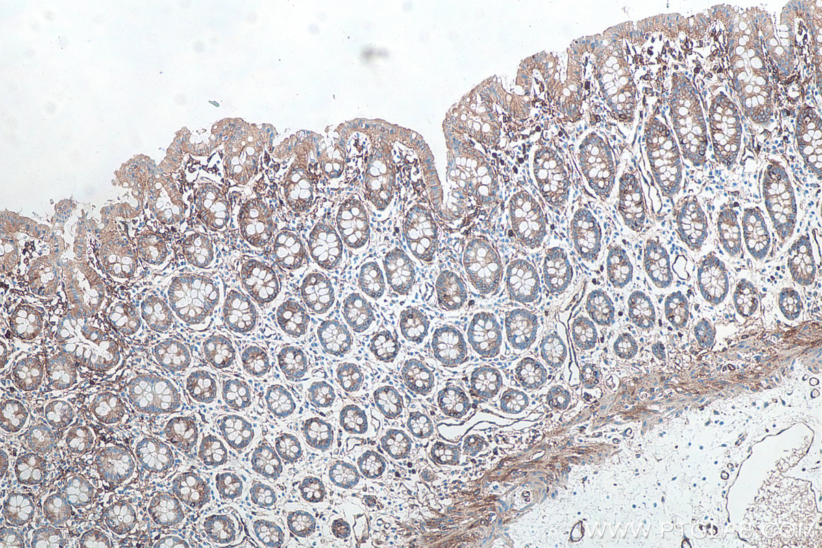 Immunohistochemical analysis of paraffin-embedded human colon tissue slide using KHC0088 (Alpha Actinin IHC Kit).