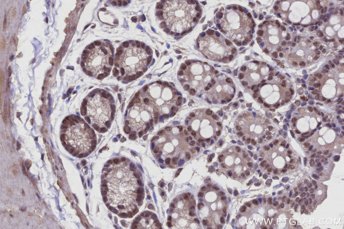 Immunohistochemical analysis of paraffin-embedded mouse colon tissue slide using KHC2926 (Arp5/ACTR5 IHC Kit).