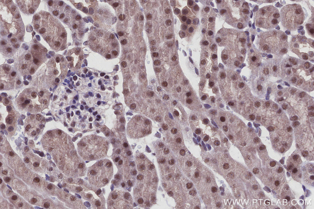 Immunohistochemical analysis of paraffin-embedded mouse kidney tissue slide using KHC2926 (Arp5/ACTR5 IHC Kit).