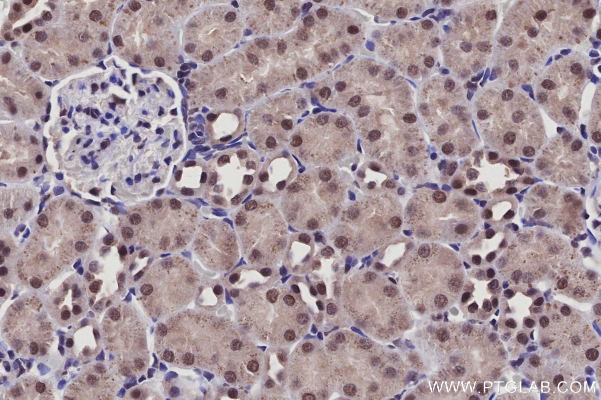 Immunohistochemical analysis of paraffin-embedded rat kidney tissue slide using KHC2926 (Arp5/ACTR5 IHC Kit).