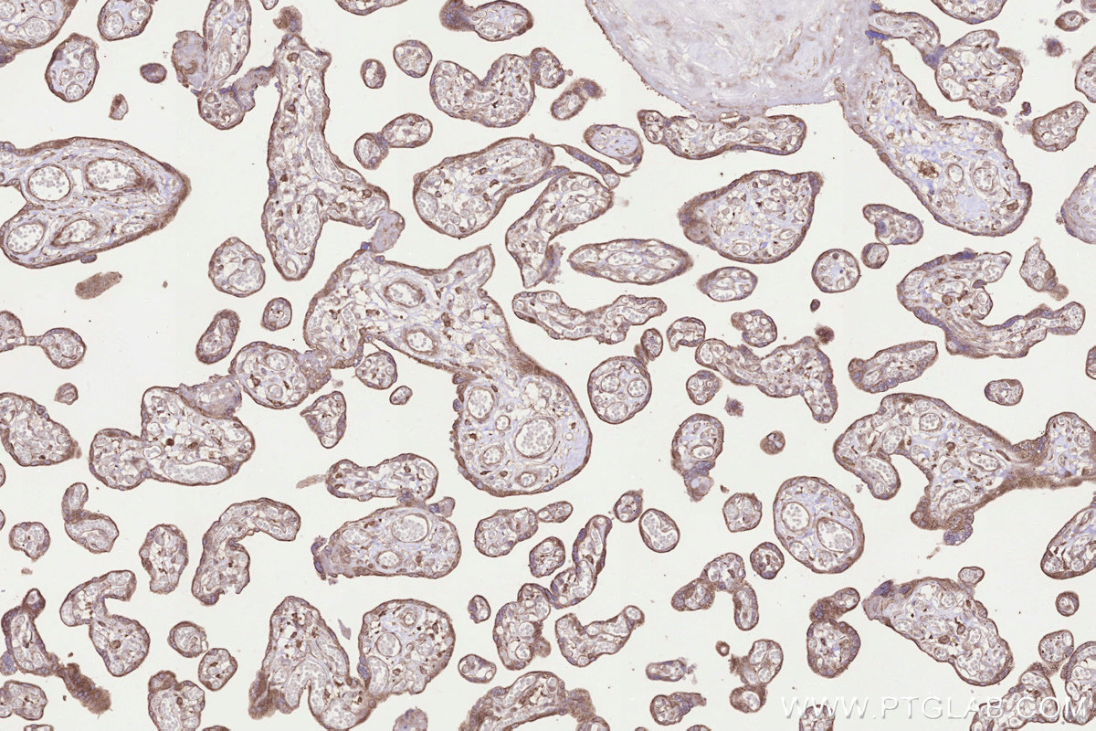 Immunohistochemical analysis of paraffin-embedded human placenta tissue slide using KHC3299 (B3GNT7 IHC Kit).