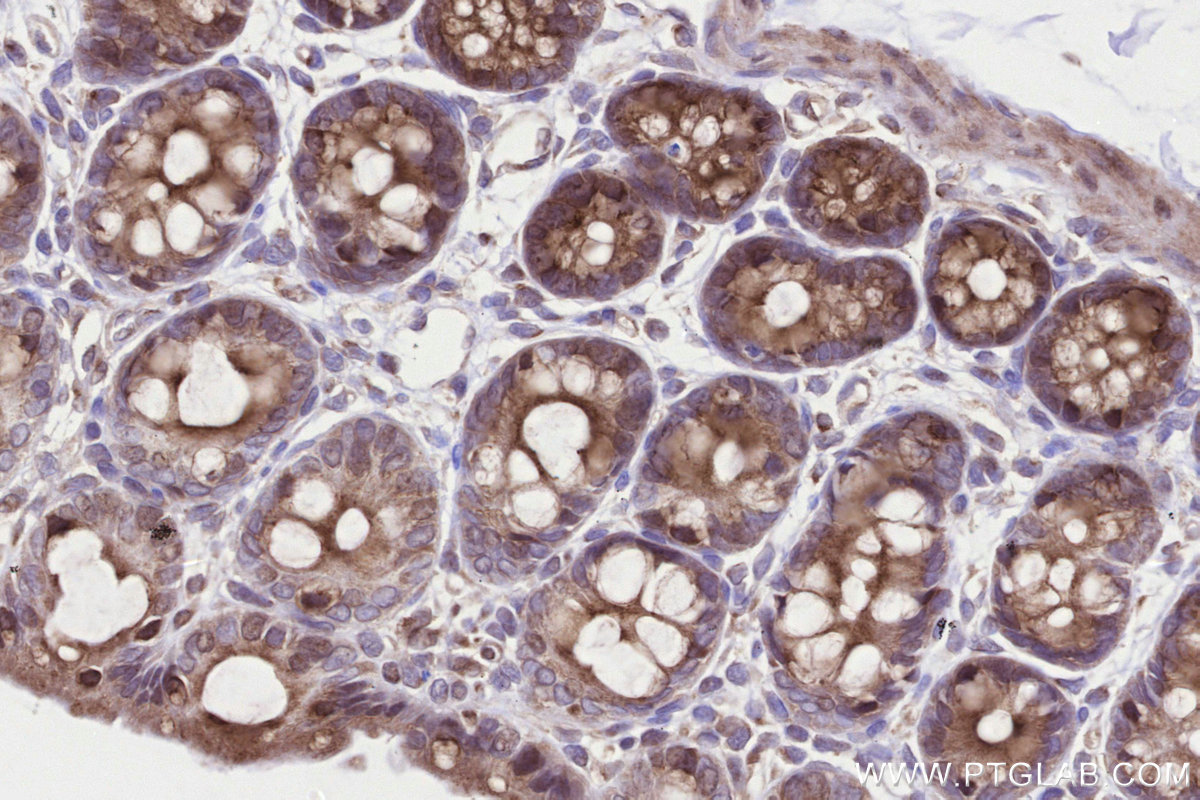 Immunohistochemical analysis of paraffin-embedded rat colon tissue slide using KHC3299 (B3GNT7 IHC Kit).