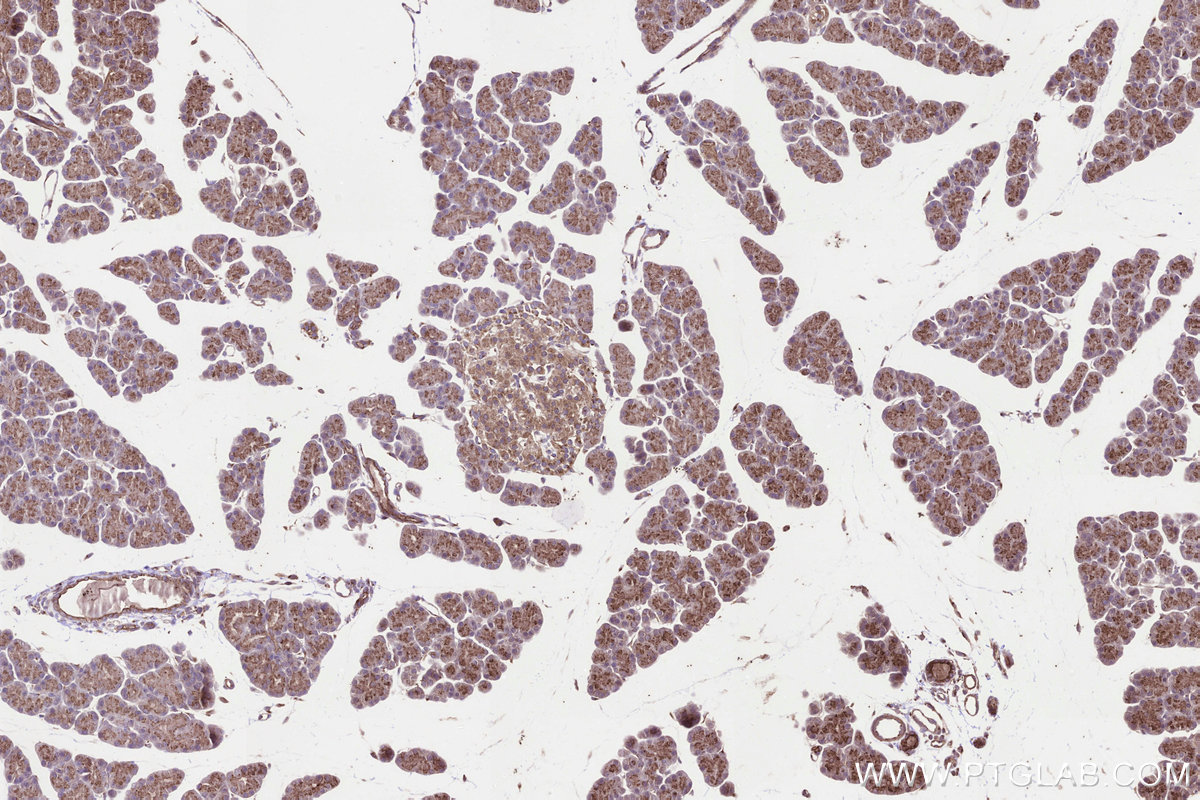 Immunohistochemical analysis of paraffin-embedded rat pancreas tissue slide using KHC3299 (B3GNT7 IHC Kit).
