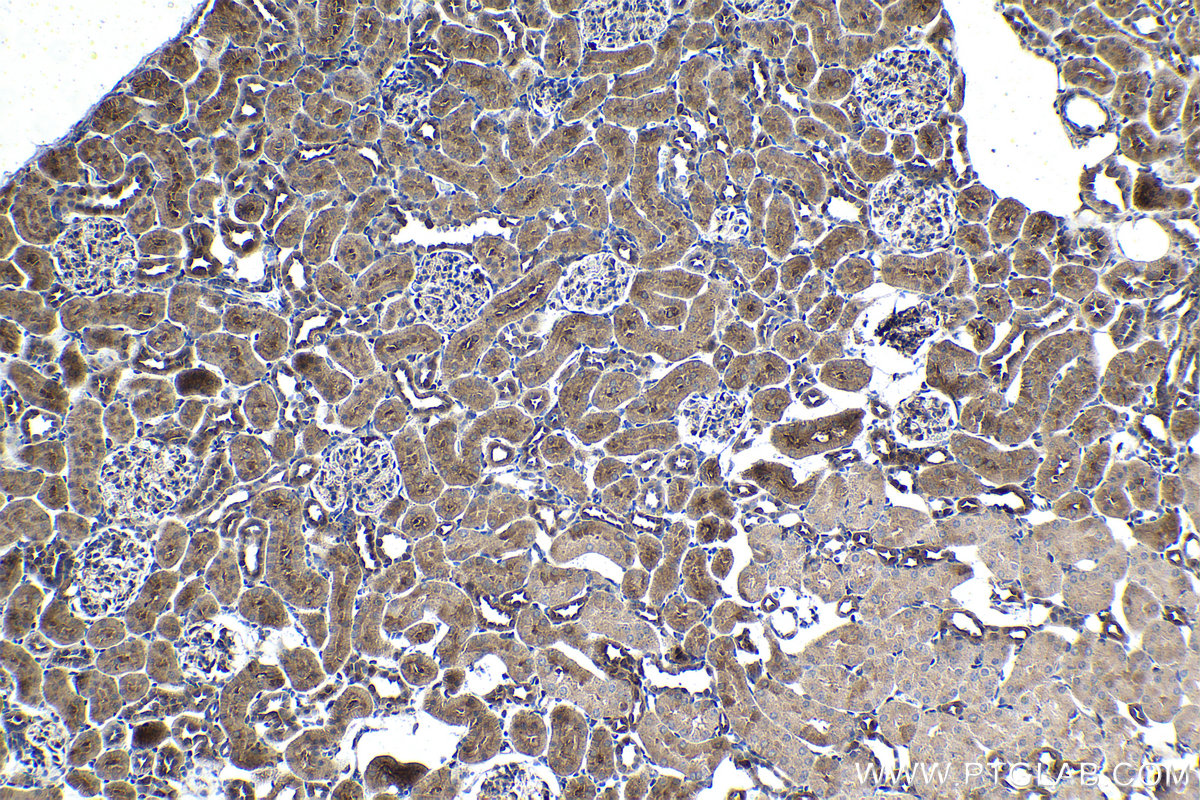 Immunohistochemical analysis of paraffin-embedded rat kidney tissue slide using KHC1500 (BAG3 IHC Kit).