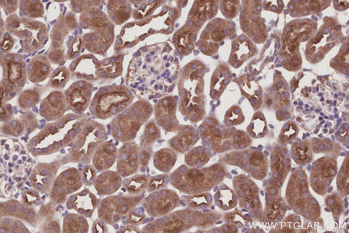 Immunohistochemical analysis of paraffin-embedded mouse kidney tissue slide using KHC3010 (BAIAP2L1 IHC Kit). Immunohistochemical analysis of paraffin-embedded mouse kidney tissue slide using KHC3010 (BAIAP2L1 IHC Kit).