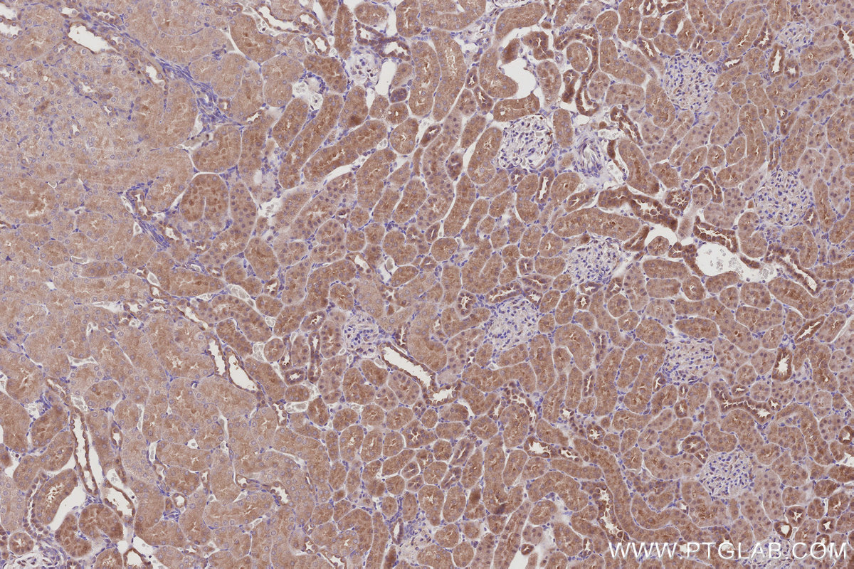 Immunohistochemical analysis of paraffin-embedded rat kidney tissue slide using KHC3010 (BAIAP2L1 IHC Kit). Immunohistochemical analysis of paraffin-embedded rat kidney tissue slide using KHC3010 (BAIAP2L1 IHC Kit).