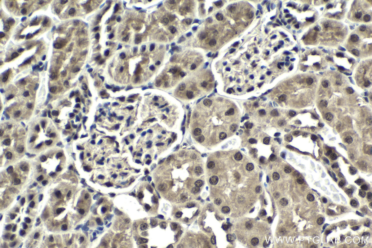 Immunohistochemical analysis of paraffin-embedded rat kidney tissue slide using KHC1759 (BATF IHC Kit).