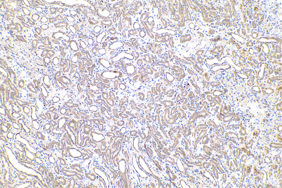 Immunohistochemical analysis of paraffin-embedded human kidney tissue slide using KHC0768 (BAX IHC Kit).