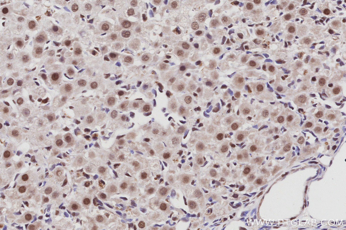 Immunohistochemical analysis of paraffin-embedded rat ovary tissue slide using KHC3013 (BAZ1B/WSTF IHC Kit).