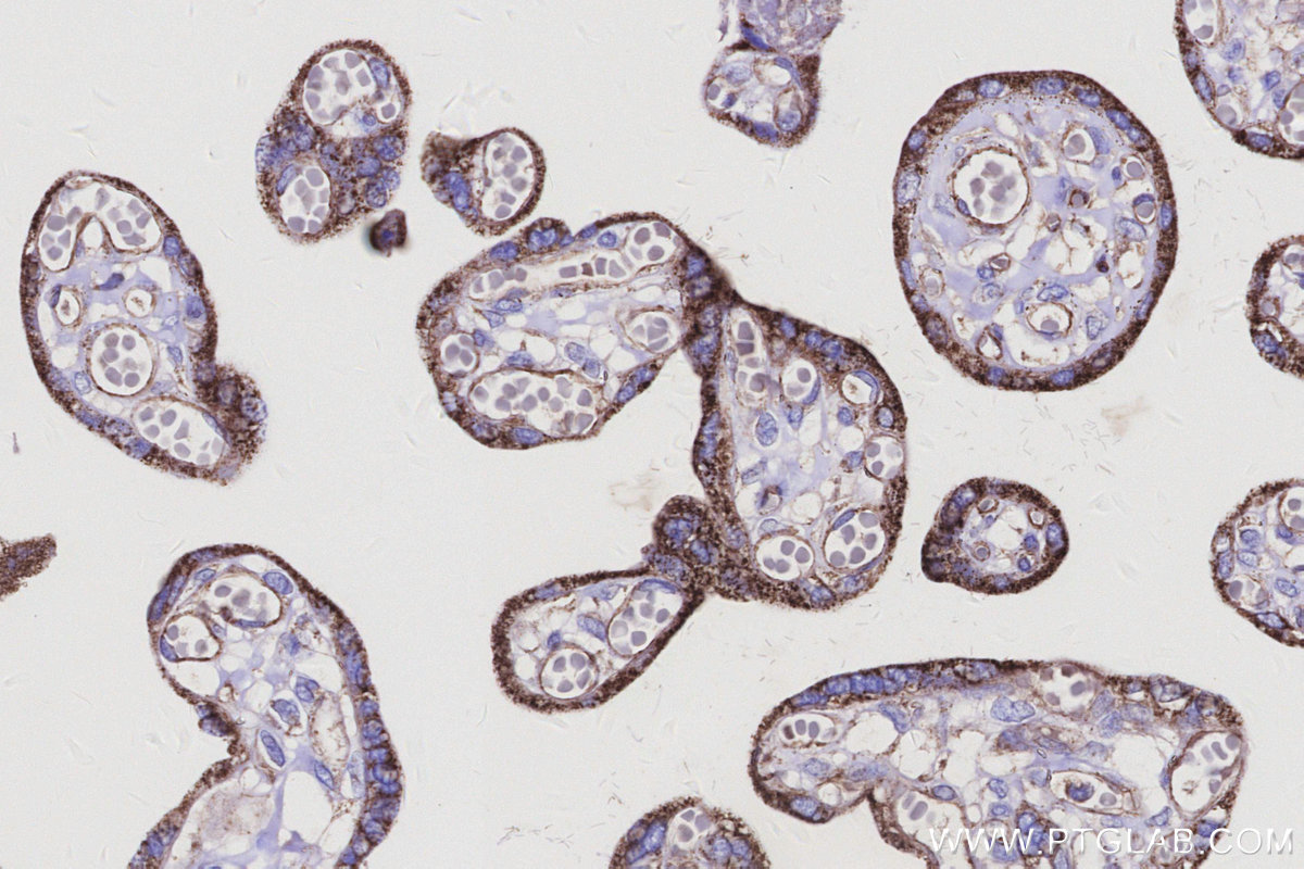 Immunohistochemical analysis of paraffin-embedded human placenta tissue slide using KHC3140 (BCAT2 IHC Kit).