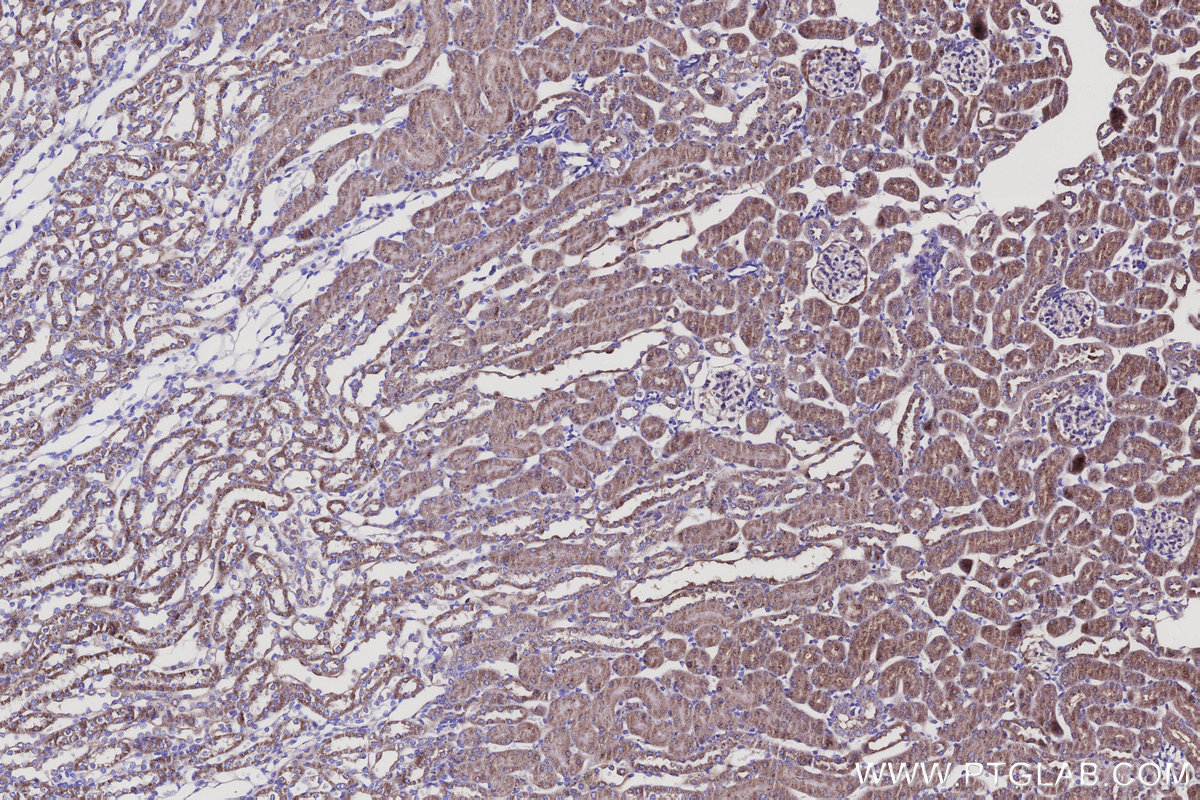 Immunohistochemical analysis of paraffin-embedded mouse kidney tissue slide using KHC3140 (BCAT2 IHC Kit).