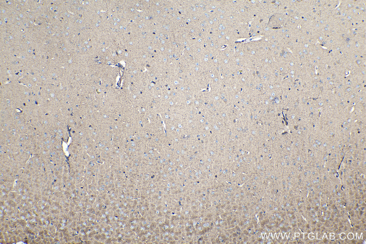 Immunohistochemical analysis of paraffin-embedded mouse brain tissue slide using KHC1411 (BCKDHA IHC Kit).