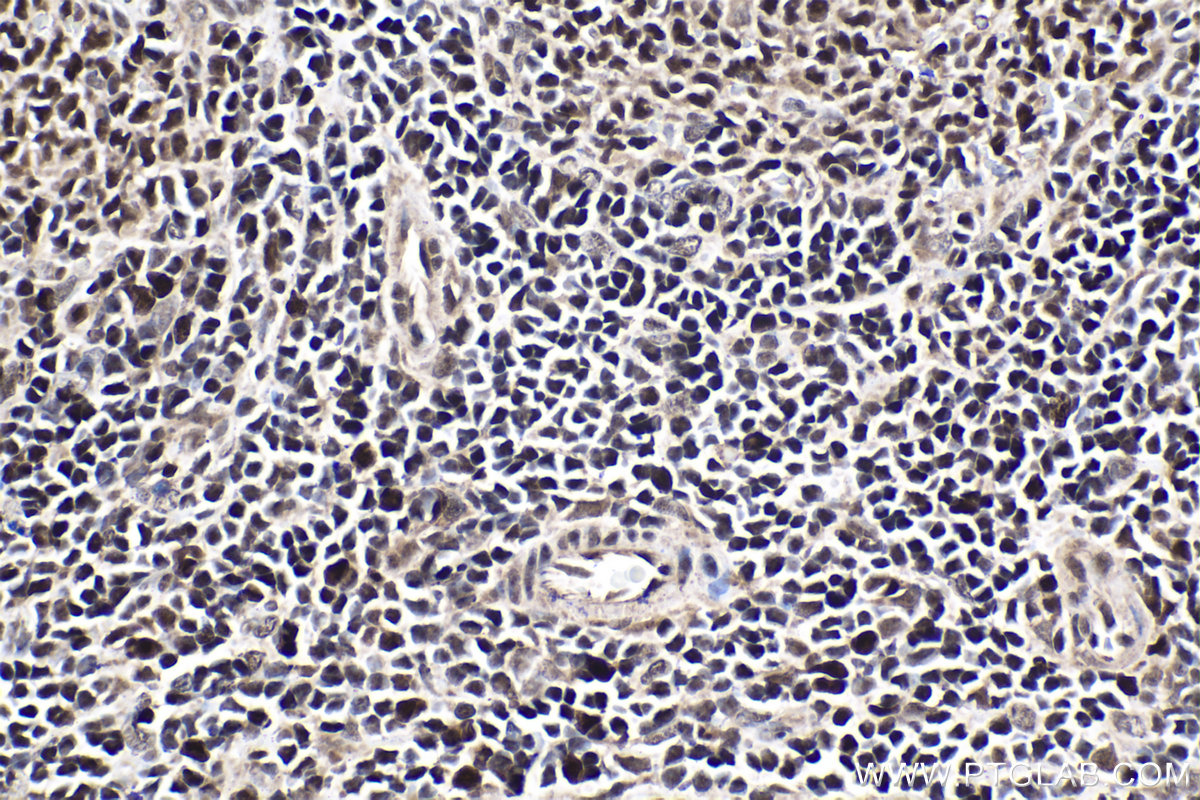 Immunohistochemical analysis of paraffin-embedded rat spleen tissue slide using KHC1923 (BCL11A IHC Kit).